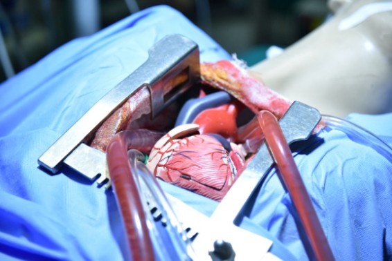 Heart Operation 1