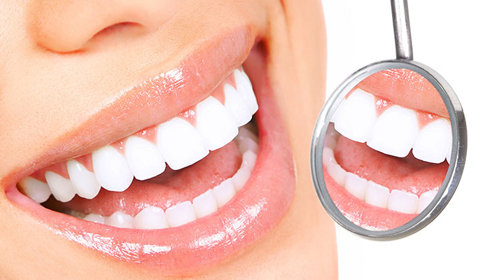 teeth-whitening