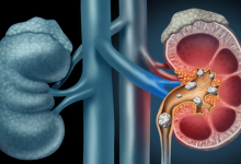 KIDNEY