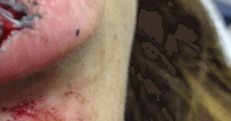 man bites lady's lips