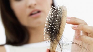 HAIR LOSS