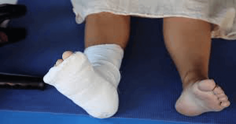 MEDICAL NEGLIGENCE, NURSING ASSISTANT SUSPENDED