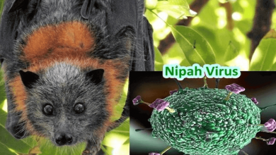 nipah virus