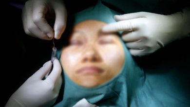 illegal plastic surgery caught in abhudabi