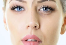 anti aging