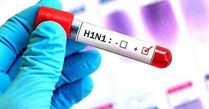 H1N1